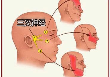 北京彭胜医院:三叉神经痛患者应如何预防疼痛发作?