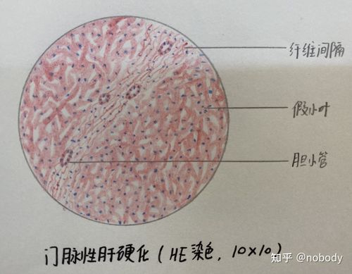 【病理学实验】红蓝铅笔绘图