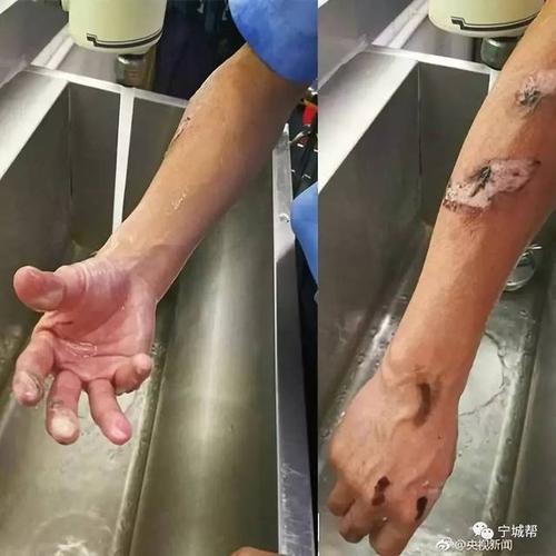 赤峰消防员女朋友千里赶来看他,没想到遇到了执勤.