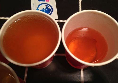 无痛血尿膀胱癌的先兆