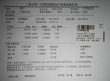 一份中期唐氏筛查报告示例