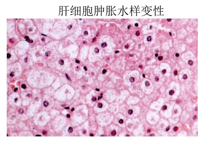 病理学图片ppt