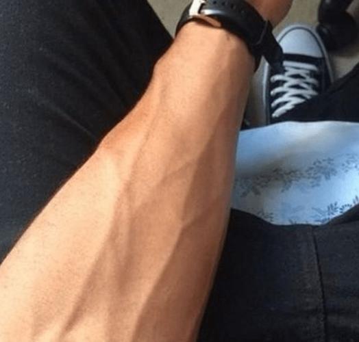 有人手臂上青筋暴起有些人却看不到青筋给你科普一下