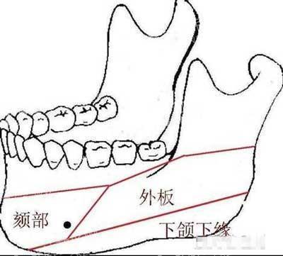 下颌角肥大整形术后没达效果怎么办?