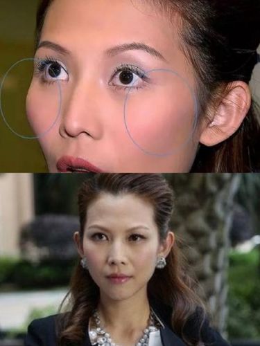颧骨高显的突兀?看看女明星是怎么做的