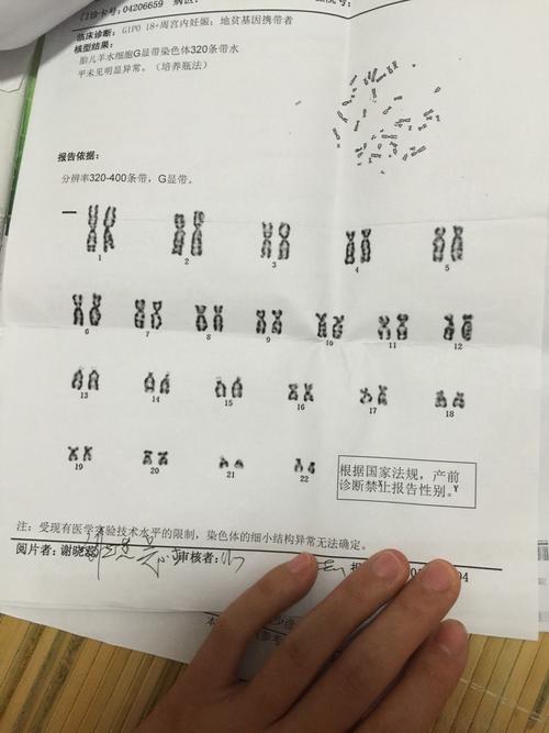 羊水穿刺分辨男女,看看我的是男宝还是女宝