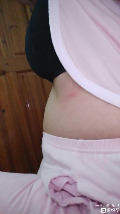 为什么我旁边那么凹进去的(胸下去一点点