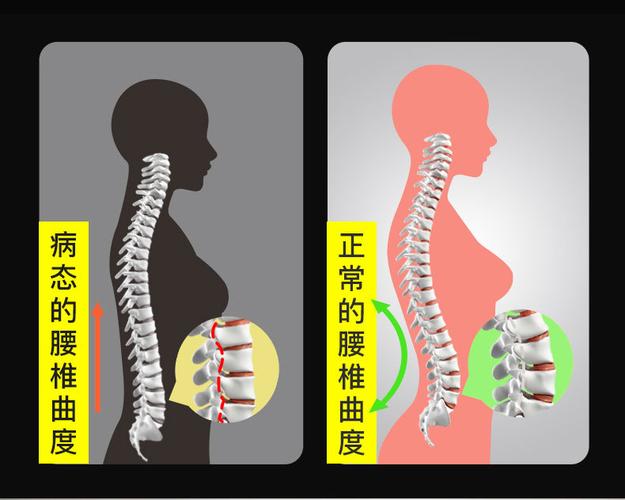 腰部按摩器热敷曲度腰椎矫的正器牵引器家用腰疼多功能成人仪理疗_6折