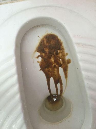 我女朋友生病了拉这样的屎 她不肯去医院 我很担心她 应该吃什么药