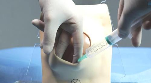 顺产分娩,是撕裂好还是侧切好?如何选择,还要看产妇这