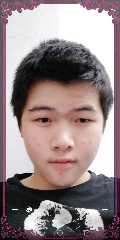 怎么回事 右脸比左脸大很多 有什么办法吗 明年开始减肥