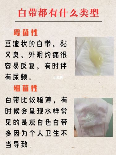 你真正懂得~~你的白带是正常的嘛?_洗液_内裤_卫生纸
