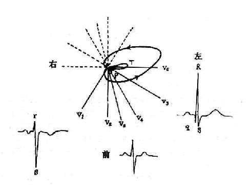 心电图学习基础