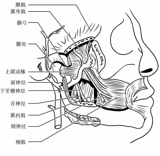 翼下颌间隙感染