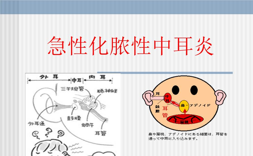 贵阳铭仁耳鼻喉医院:你一定要知道!耳科常见病——急性化脓性中耳炎