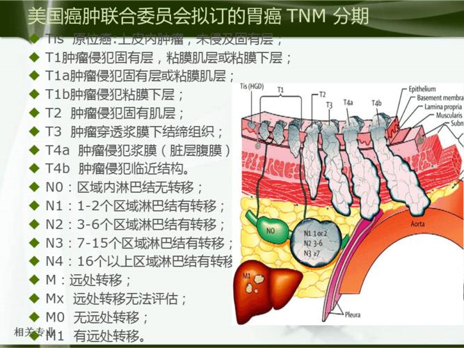 胃癌的 tnm分期【研究荟萃】