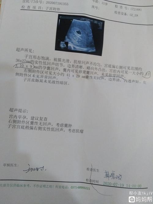 昨天检查怀孕68天,彩超检查显示孕囊23