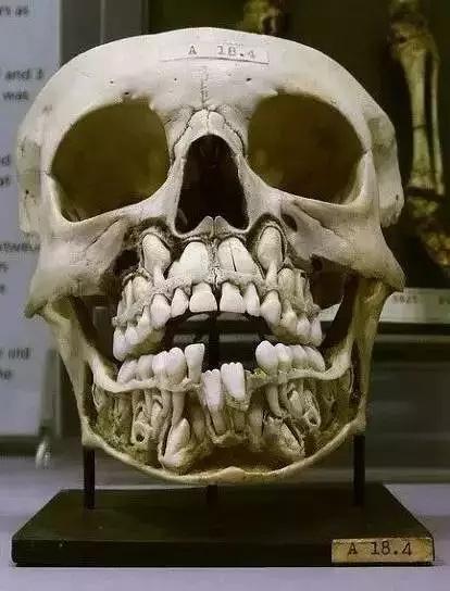 图片可能引起不适我觉得正在换牙的小孩的牙片很有趣有没有同好