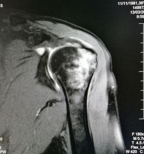 渭南市第三医院ct&mri室简介