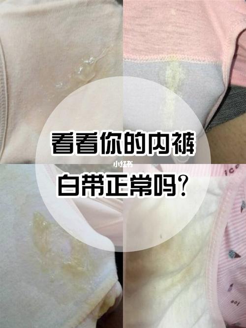 白带异常98赶快行动94_私处_妇科炎症_内裤_凝胶