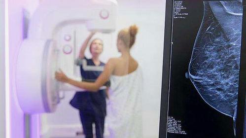 女性体检时做"胸透",会暴露隐私部位吗?医生:别害羞!