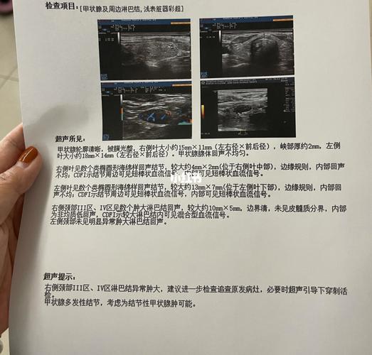 老妈锁骨上淋巴异常肿大,本人快崩溃了_甲状腺_淋巴结