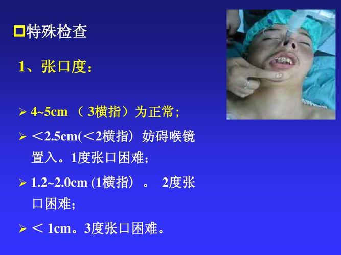 特殊检查 1,张口度: ,张口度: 4~5cm   3横指)为正常; 横指) 横指 为