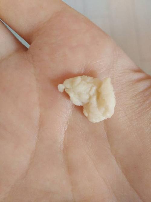 今天早上白带突然变成乳白色了,味道好像是有种放时间