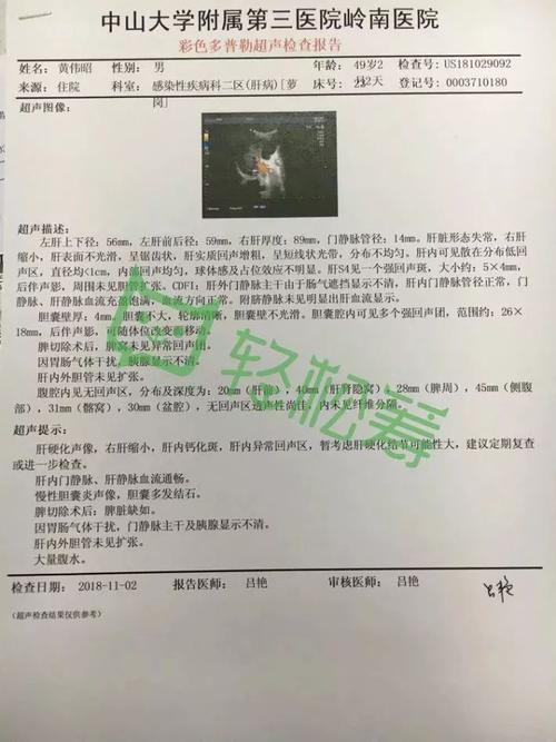 可怜| 澄海男子皮肤突然变黄,腹部积水,没想到竟是因为