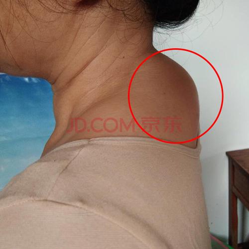 颈椎富贵包消除贴疏通颈部鼓包专用去大椎包疼痛器品热敷帖