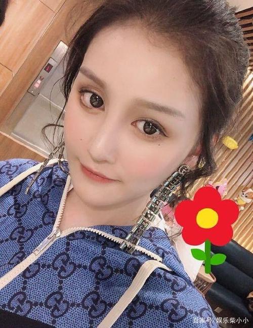 赵本山女儿球球狂瘦50斤,判若两人,"整容"后遗症明显