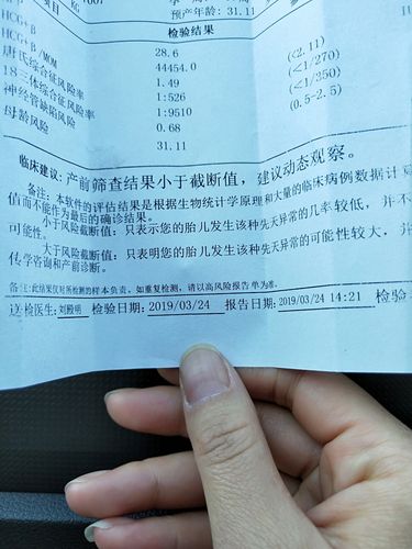 我们这儿的大夫建议我做dna或羊水穿刺,有懂得朋友帮我我看一