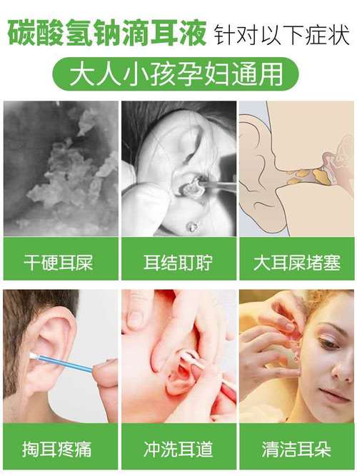 碳酸氢钠滴耳液耳屎软化儿童宝宝耵聍耳药水洗耳液人用滴耳油耳朵