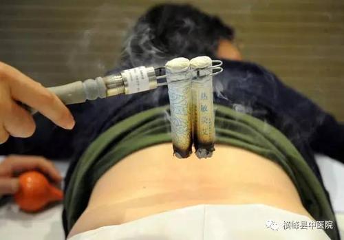 省中医院专家团携"热敏灸"走进横峰大型义诊