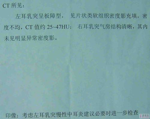 讨论】以耳部侵犯为首发症状的鼻咽癌    2006年7月25日外院ct报告