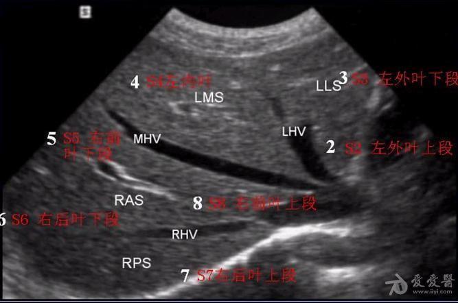 肝脏的分叶分段(解剖 超声声像图)