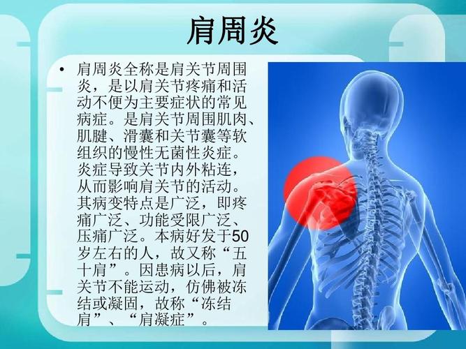 肩周炎病因病理及循证医学