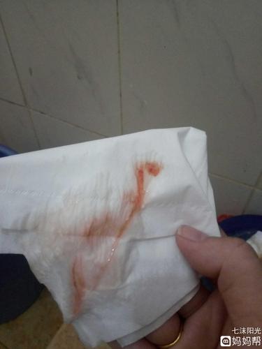 怀孕35周 3刚上厕所有少量红血丝,这是