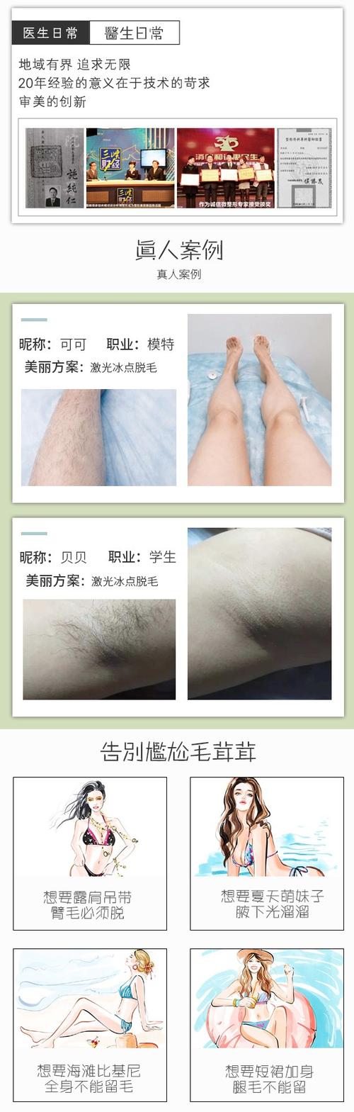 比基尼脱毛单次私密脱毛三角区肛周二选一超冰超舒适