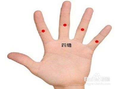 中医治疗小儿疳积