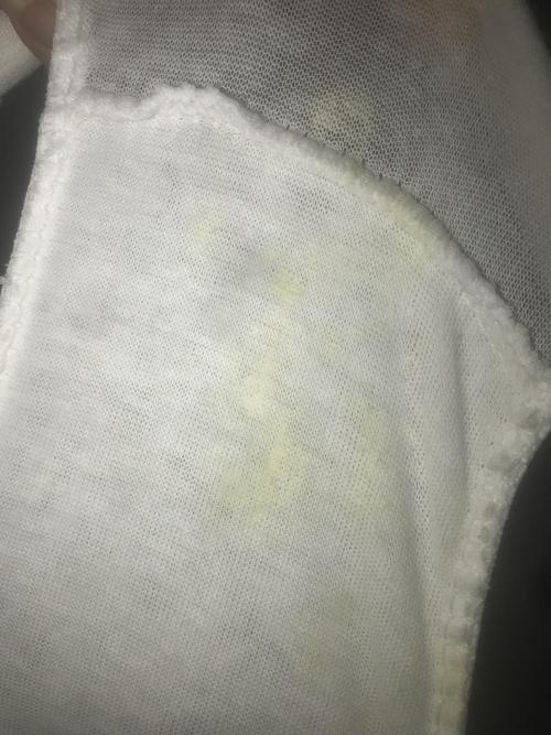 白带腥臭,水样黄绿色,还痒,疫情封闭了小区没法去医院看病怎么办啊(有