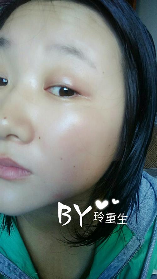 发现几乎每个月我的眼睛都要上火肿一次