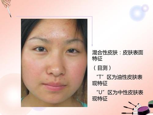 皮肤分析ppt
