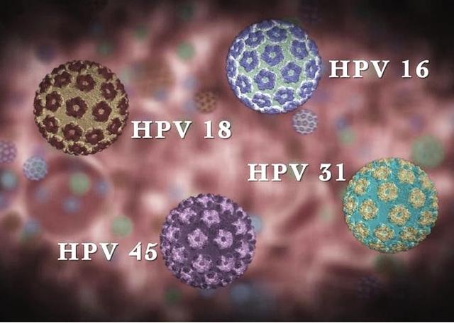 hpv病毒感染科普