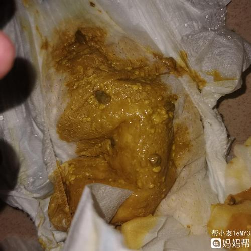 宝宝便便是消化不良嘛?内有图慎入