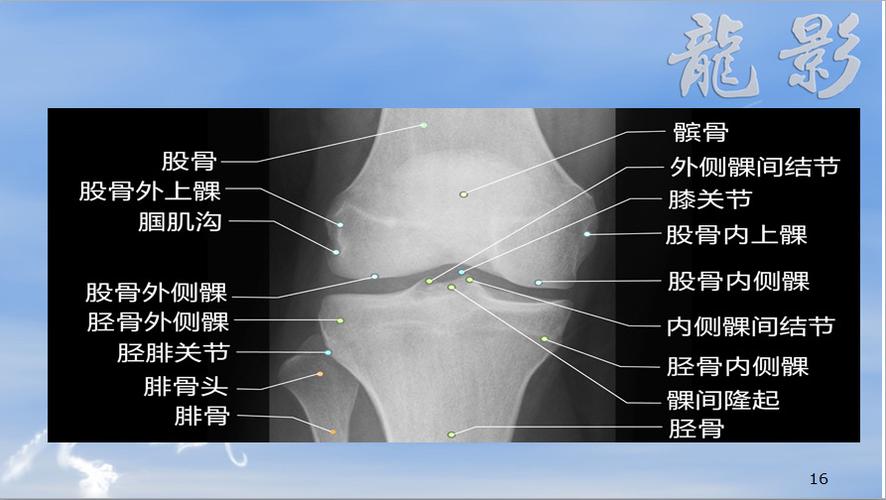 膝关节断层解剖