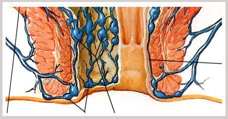 脱肛和痔疮的区别