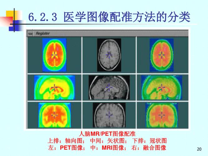 第6章医学图像配准与融合上