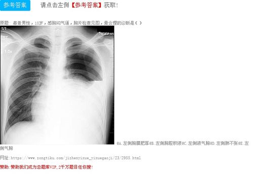 左侧胸膜肥厚 b.左侧胸腔积液 c.左侧液气胸 d.左侧肺不张 e.
