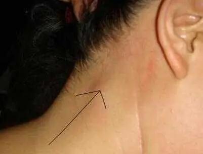 b超单子上面显示的是淋巴结肿大,以及一个下颌囊肿,不知道怎么回事